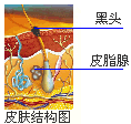 皮肤结构和黑头的关系